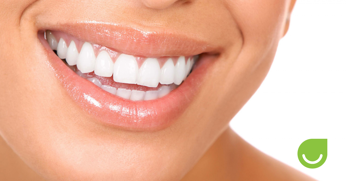 Teeth Whitening Seattle Smiles Dental Teeth Whitening Seattle Smiles Dental