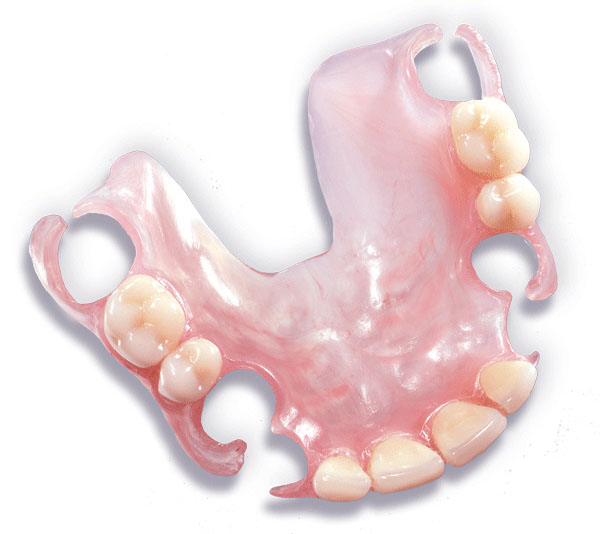 Seattle Smiles Dental – Acrylic-only Partials