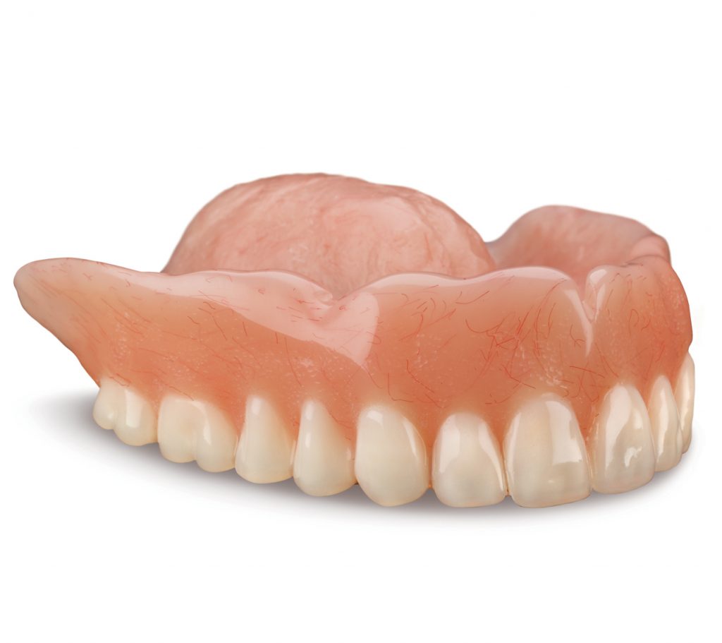 Seattle Smiles Dental – Full upper denture