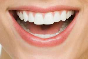 Seattle Smiles Dental – Intraoral Camera Services