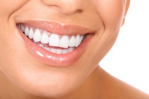 Seattle Smiles Dental – Whitening Services